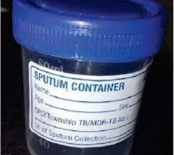 Disposable 50 Ml Sputum Container